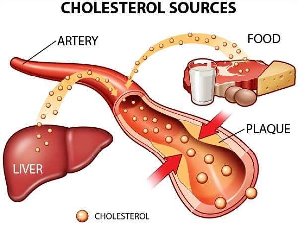 cholesterol-roi-loan-mo-mau