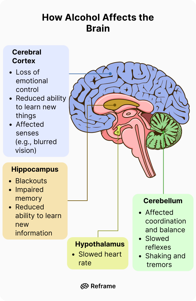 Chuyên Đề: Nồng Độ Cồn Trong Máu, Quy Định Pháp Luật Và Hệ Lụy Sức Khỏe Toàn Diện 2 Sơ đồ minh họa tác động của nồng độ cồn lên não bộ qua các giai đoạn (từ hưng phấn đến hôn mê)