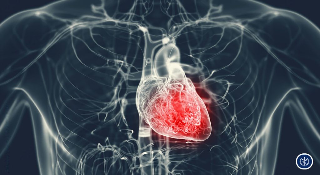 Cập Nhật Phác Đồ Điều Trị Tăng Huyết Áp Theo Khuyến Cáo ESC/ISH 2025: Những Thay Đổi Trọng Yếu 1 Cap Nhat Phac Do Dieu Tri Tang Huyet Ap Theo Khuyen Cao ESC ISH