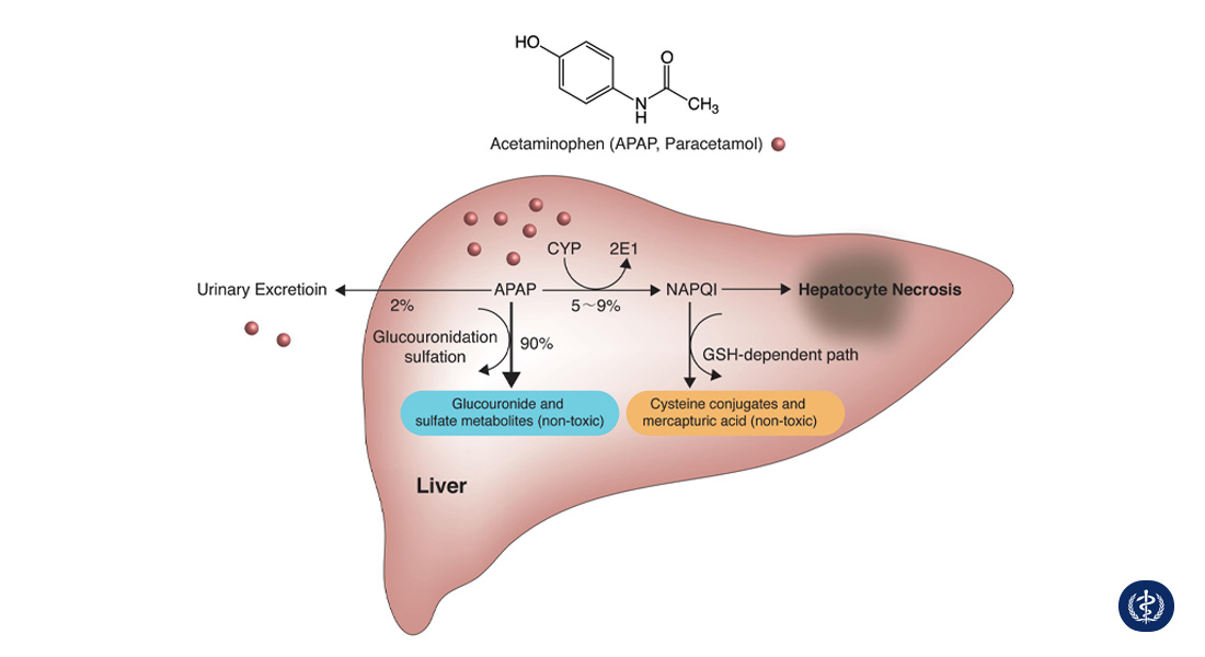 Sử Dụng Thuốc Giảm Đau Hạ Sốt Paracetamol An Toàn Tại Gia Đình 3 Nguy cơ ngộ độc gan do dùng Paracetamol quá liều